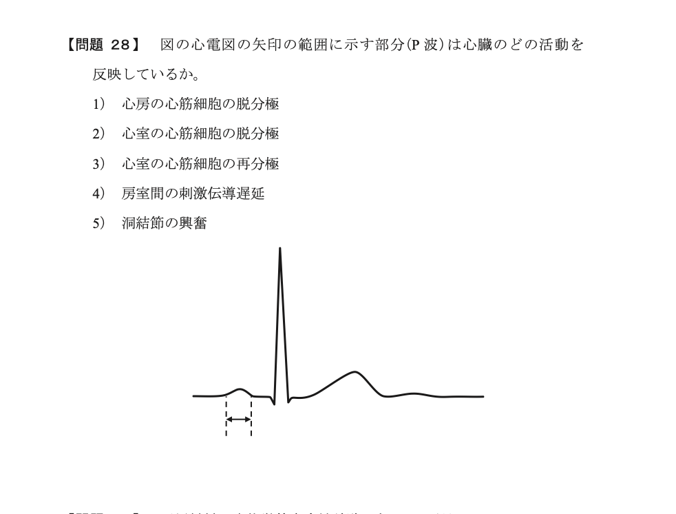 AM28 図表