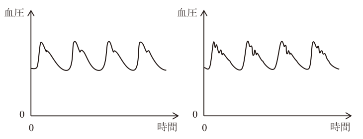 観血式血圧計で測定した血圧波形の変化