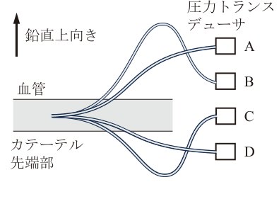 観血血圧トランスデューサ配置