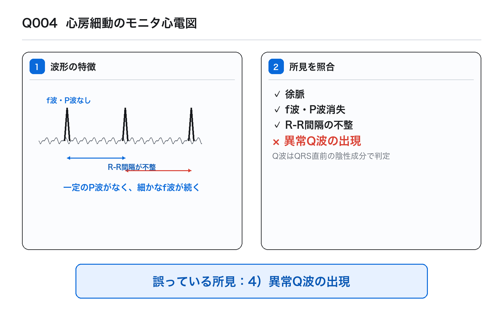 第42回PM 問題4の解説図: 心房細動のモニタ心電図