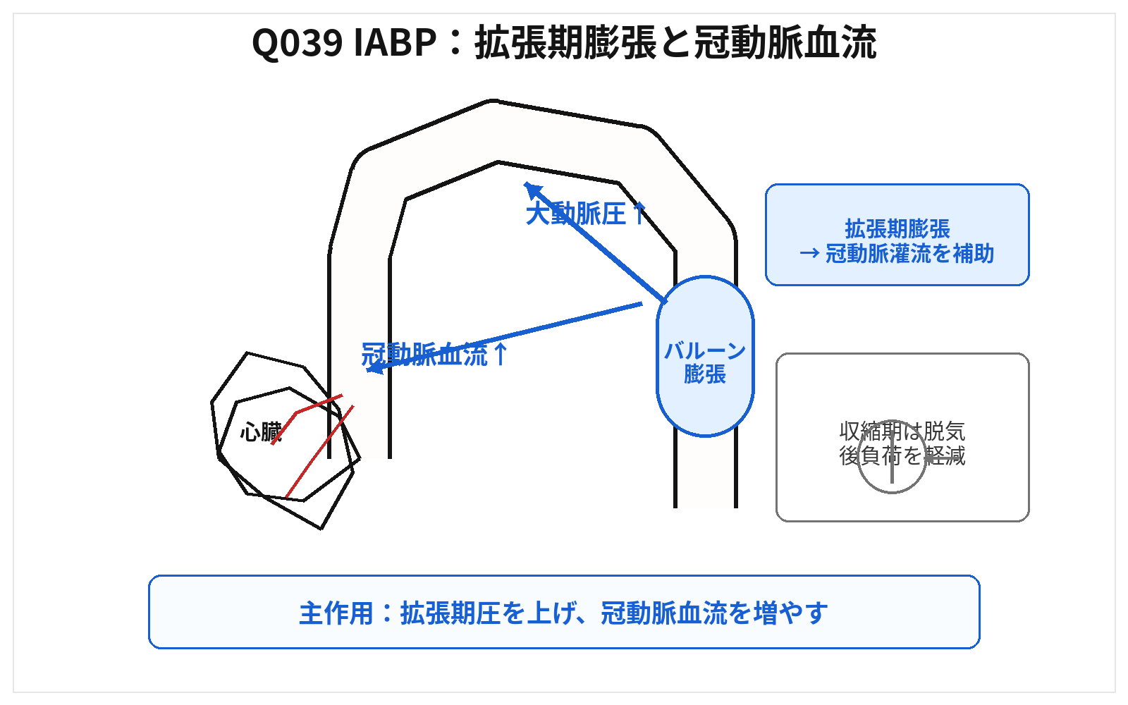 第46回AM 問題39の解説用図表: IABP