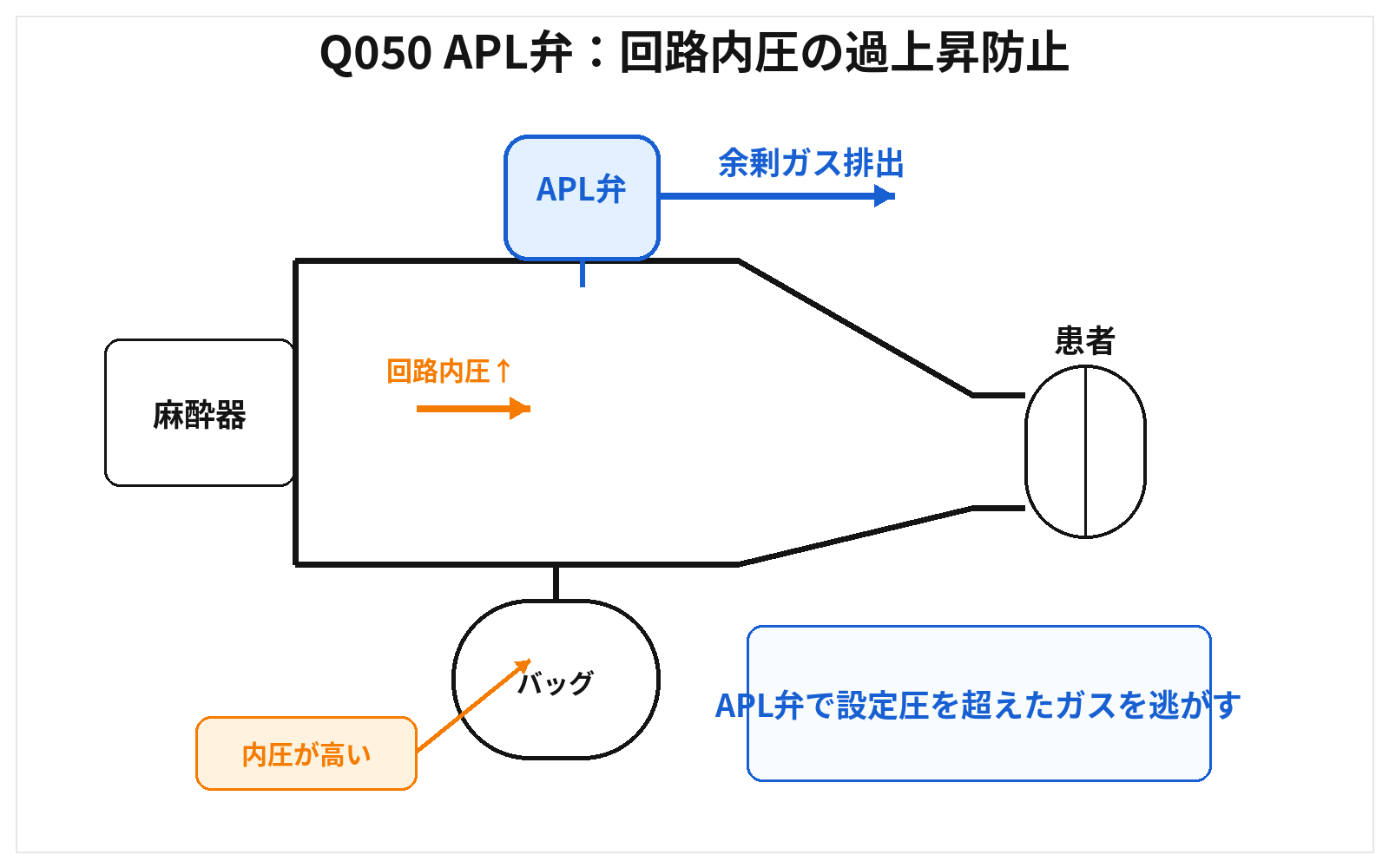 第46回AM 問題50の解説用図表: APL弁