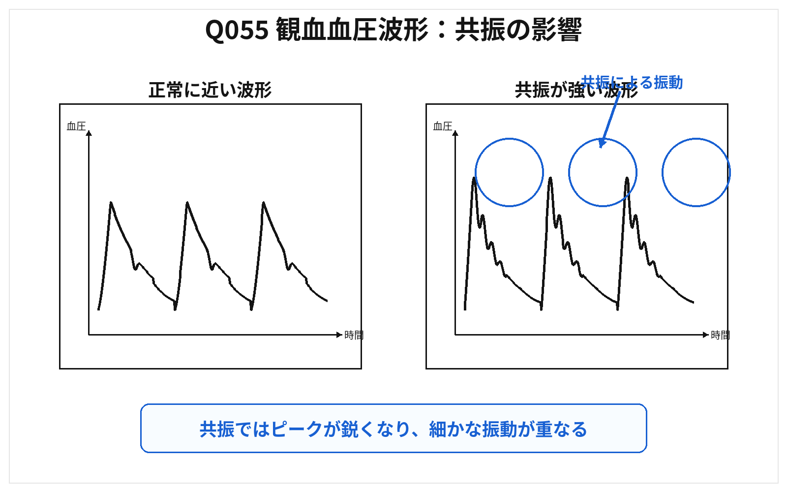 第46回AM 問題55の解説用図表: 観血血圧共振