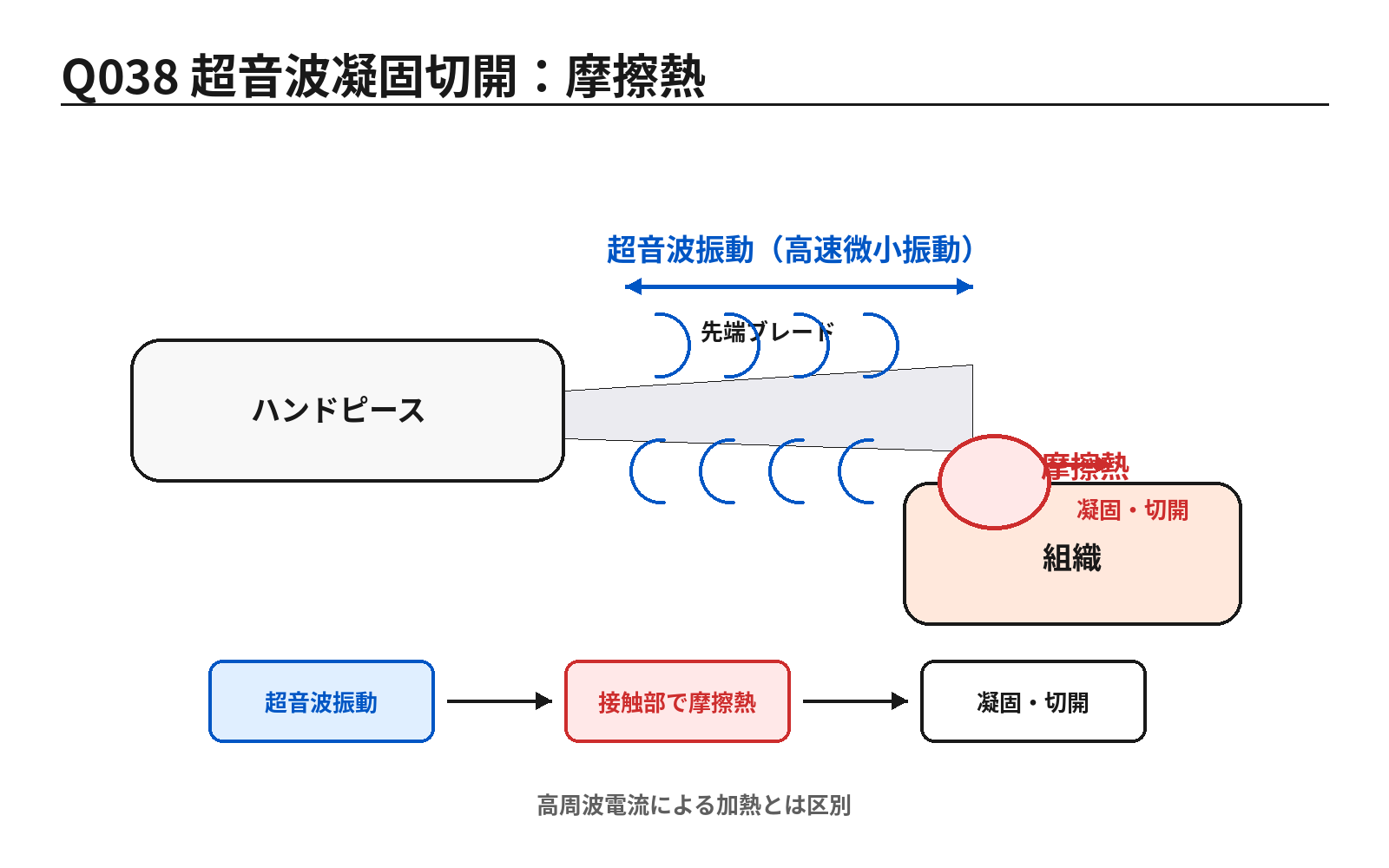 第46回PM 問題38の解説用図表: 超音波凝固切開装置と摩擦熱