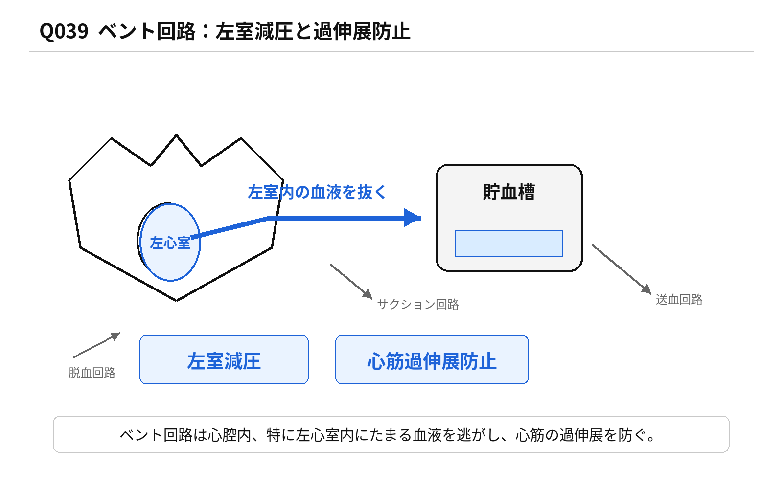 第46回PM 問題39の解説用図表: 人工心肺ベント回路