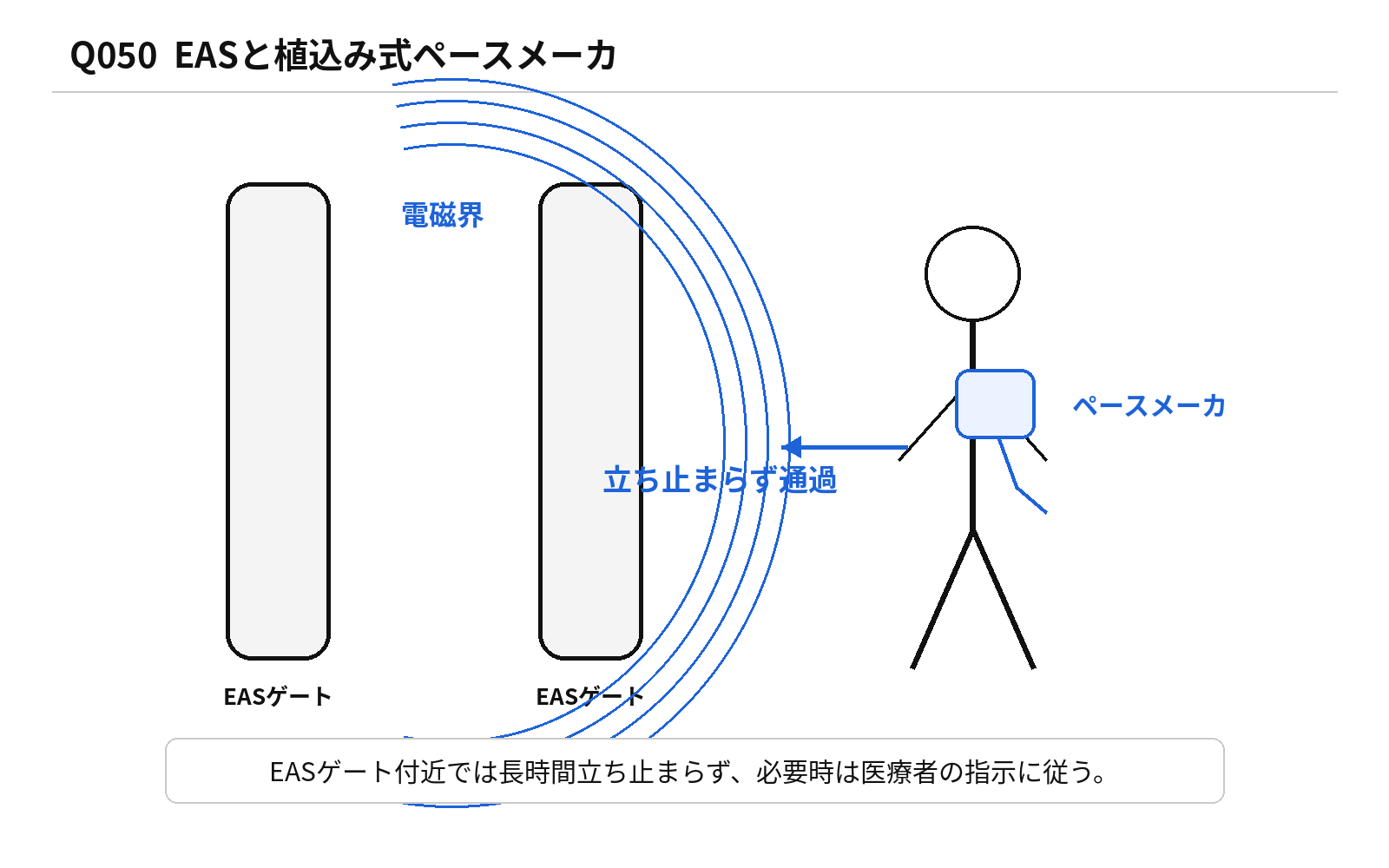 第46回PM 問題50の解説用図表: 植込み式ペースメーカとEAS