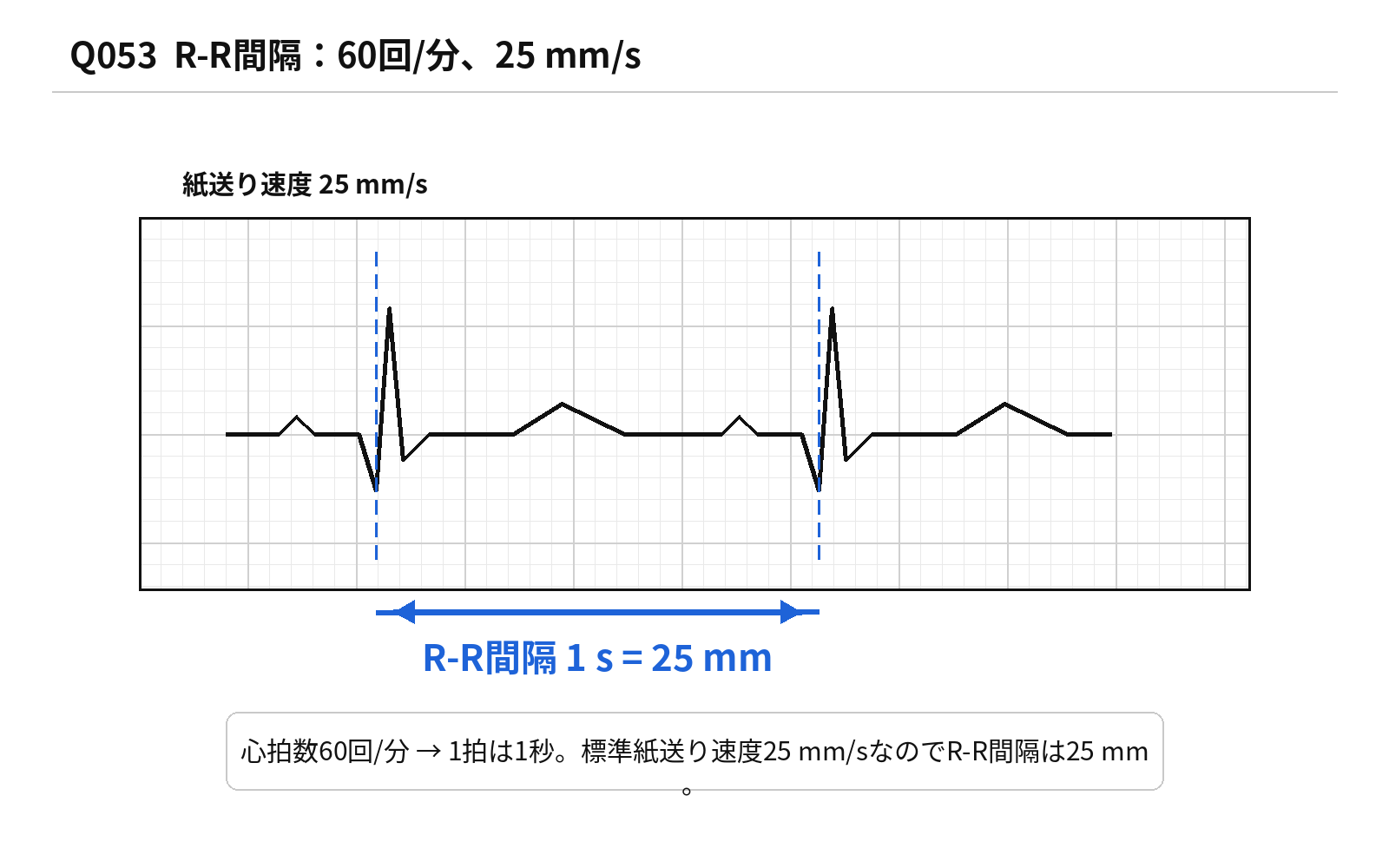 第46回PM 問題53の解説用図表: 心拍数60回/分とR-R間隔